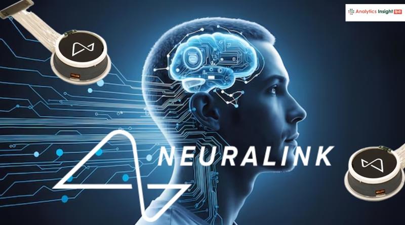 अब जी नहीं सकता… Neuralink चिप वाले पहले इंसान का खुलास